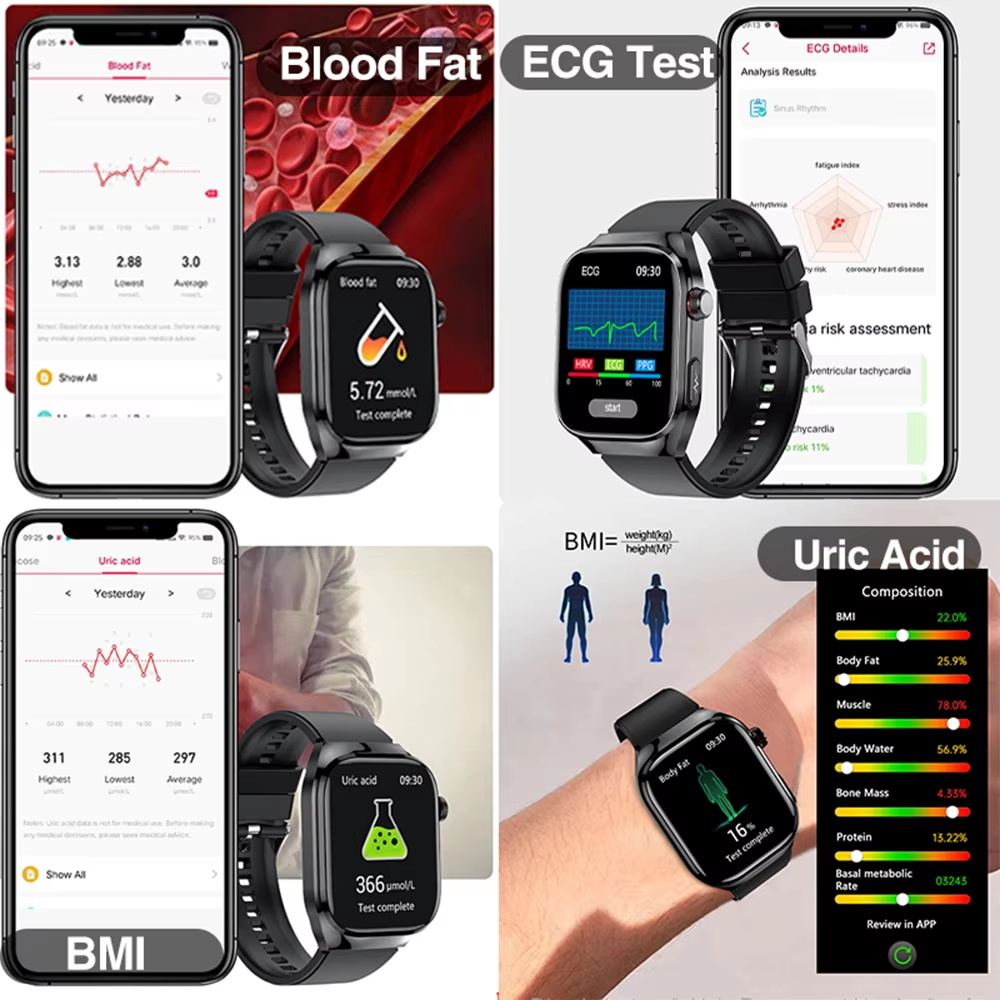 2026 New Nursing Grade Uric Ac - Smart Home Energy Management ulasan dan harga